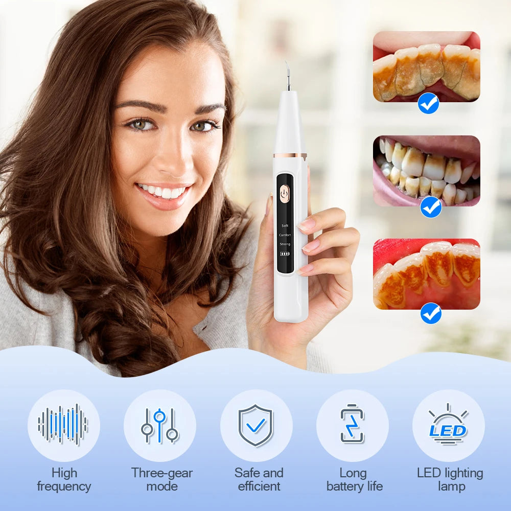 Cura Cleanse™ Plaque Remover